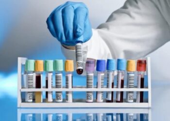 რა ანალიზები უნდა ჩაიტაროთ თუკი ფიქრობთ, რომ აფლატოქსინის შემცველი პროდუქტები მიიღეთ?