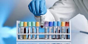 რა ანალიზები უნდა ჩაიტაროთ თუკი ფიქრობთ, რომ აფლატოქსინის შემცველი პროდუქტები მიიღეთ?