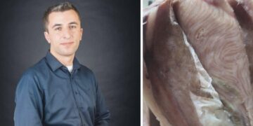 ,,რადგან პარაზიტების თემა აქტუალურია, ინფორმაციას მოგაწვდით” – რას ამბობს სურსათის უვნებლობის სპეციალისტი?