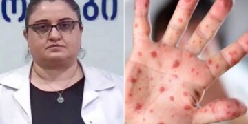 ინფექციონისტი საგანგებო მიმართვას ავრცელებს!