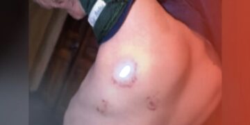 სასტიკი ძალადობა ბავშვზე – არასრულწლოვანი ბიჭი ბებიამ საღორეში ჩაკეტილი იპოვა! – შემზარავი შემთხვევის დეტალები