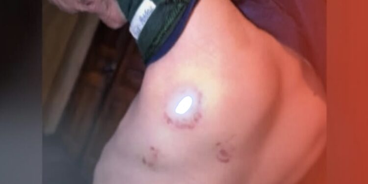 სასტიკი ძალადობა ბავშვზე – არასრულწლოვანი ბიჭი ბებიამ საღორეში ჩაკეტილი იპოვა! – შემზარავი შემთხვევის დეტალები