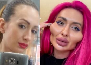 „ასე დაიმახინჯა ანამ თავი პლასტიკური ოპერაციებით” – ვინ არის გოგონა, რომლის ფოტოებმაც ინტერნეტსივრცე მოიცვა?