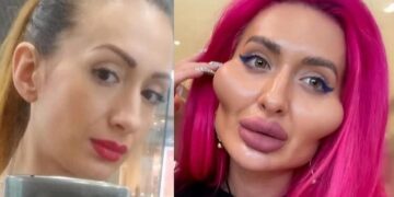 „ასე დაიმახინჯა ანამ თავი პლასტიკური ოპერაციებით” – ვინ არის გოგონა, რომლის ფოტოებმაც ინტერნეტსივრცე მოიცვა?