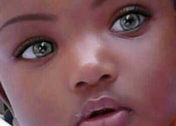 „თოჯინა გაიზარდა!“ — ეს პატარა გოგონა ყველაზე ლამაზ ბავშვად ითვლებოდა მსოფლიოში, და აი, როგორ გამოიყურება ის ახლა, 17 წლის ასაკში