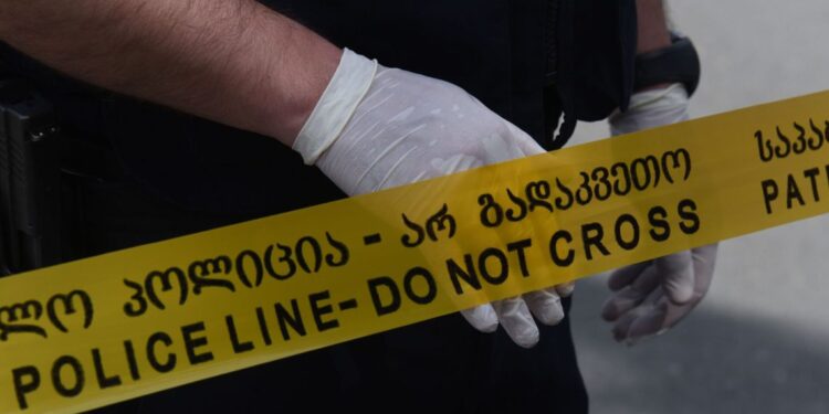 სახის ძვლები აქვს ჩალეწილი რა საზარელი ინფორმაცია ვრცელდება?