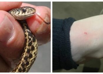 ბავშვს მინდორში თამაშის დროს გველის წიწილმა უკბინა – როგორია მისი მდგომარეობა