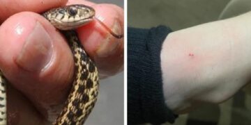 ბავშვს მინდორში თამაშის დროს გველის წიწილმა უკბინა – როგორია მისი მდგომარეობა