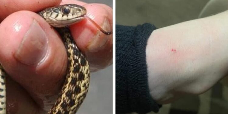 ბავშვს მინდორში თამაშის დროს გველის წიწილმა უკბინა – როგორია მისი მდგომარეობა