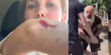 (ვიდეო) არსებული ინფორმაციით ლუკა კურტანიძემ ყოფილი ცოლი სცემა, ვრცელდება ერთ-ერთი დაპირისპირების კადრები