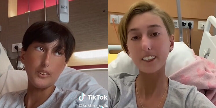 ,,ექიმი გაოგნებული იყო, რა ხდება ჩვენს თავს არ ვიციო” – ახალგაზრდა გოგოს, რომელსაც მთელი საქართველო გულშემატკივრობს, სიახლე აქვს