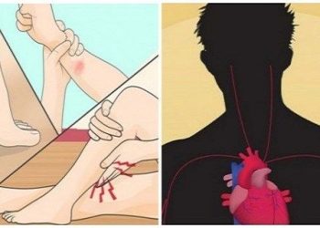 9 სიმპტომი რომელიც მიგანიშნებთ, რომ მაგნიუმის ნაკლებობა გაქვთ