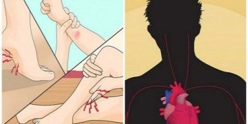 9 სიმპტომი რომელიც მიგანიშნებთ, რომ მაგნიუმის ნაკლებობა გაქვთ