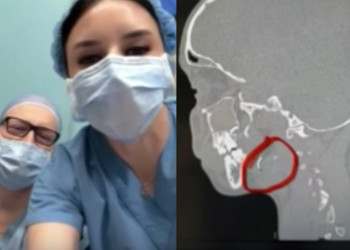 ,,12 წლის გოგონა 9 წელი ცხოვრობდა ყბა-სახსარში ჩატეხილი ნემსით…” – რა კადრებს აქვეყნებს მედეა იობაშვილი?