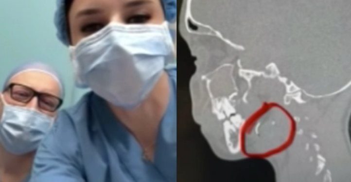 ,,12 წლის გოგონა 9 წელი ცხოვრობდა ყბა-სახსარში ჩატეხილი ნემსით…” – რა კადრებს აქვეყნებს მედეა იობაშვილი?