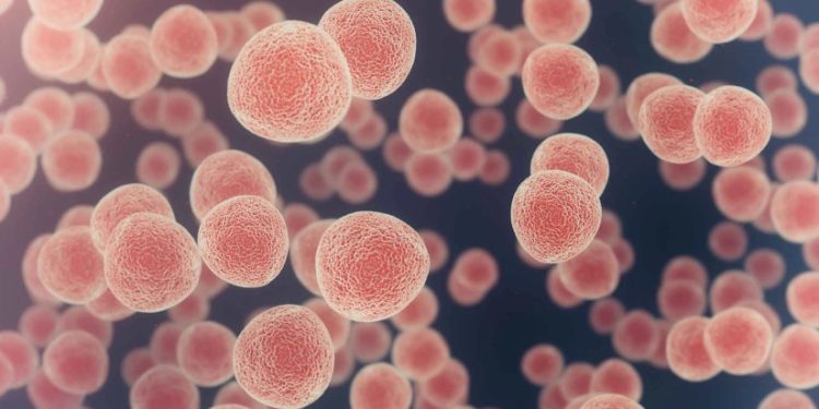 ექიმებმა „ჩუმი“ კიბოს მოულოდნელი სიმპტომი დაასახელეს